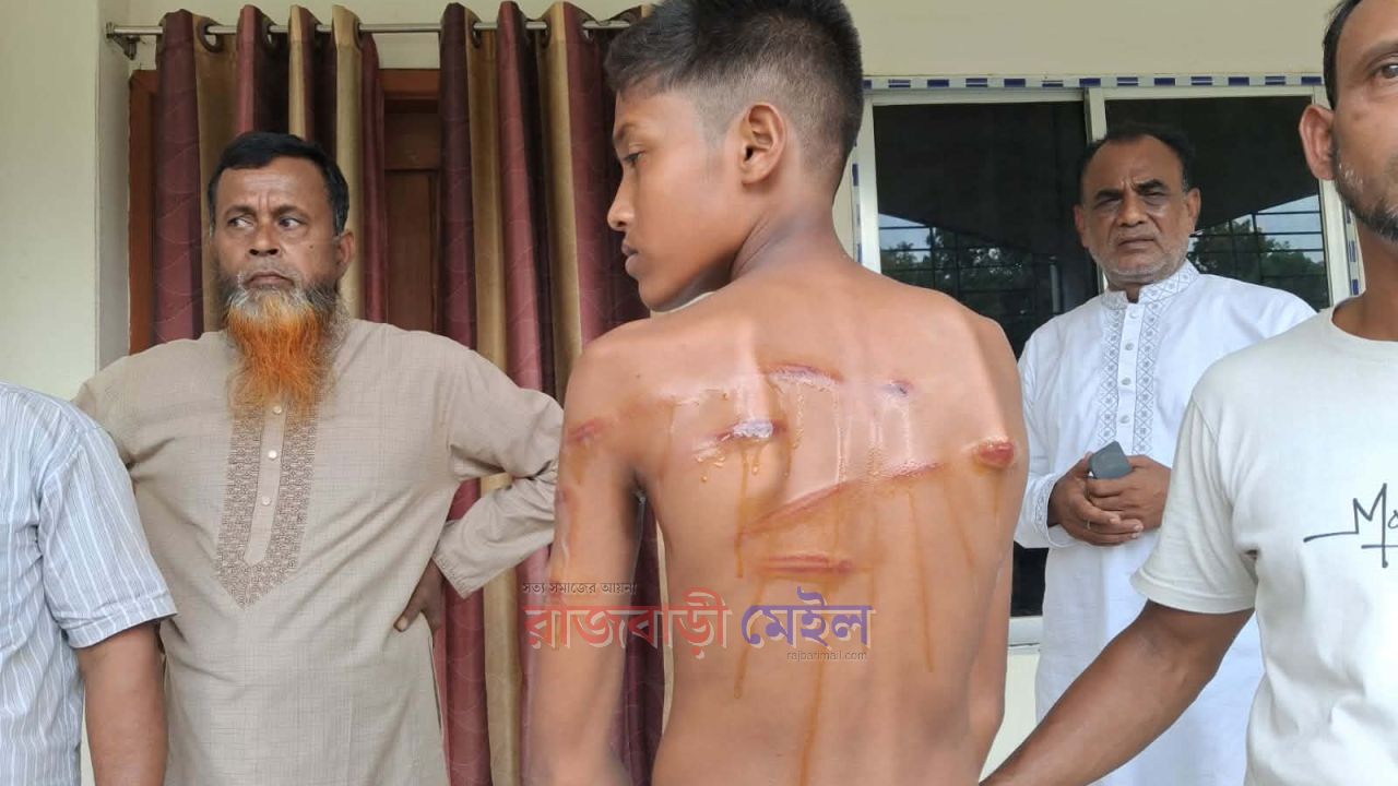 পড়া না পারায় শিক্ষার্থীকে বেত্রাঘাত করে জখমের অভিযোগ, শিক্ষককে অব্যহতির দাবি
